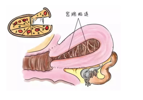 試管嬰兒花費(fèi)明細(xì)表