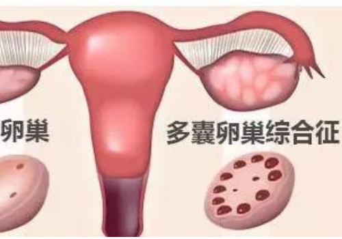 做試管嬰兒多少錢？
