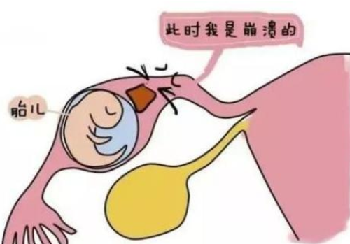 二代試管嬰兒成功率高不高？